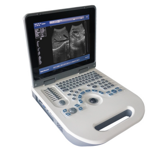 TV 5000 Mobile Veterinary Ultrasound Machine Questions & Answers